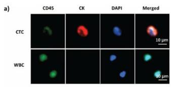循環(huán)腫瘤細(xì)胞（circulating tumour cell）