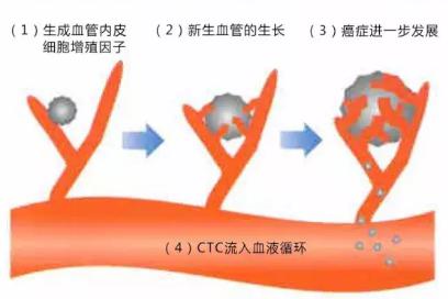 CTC檢查是測定血液中流動癌細(xì)胞的一種檢查