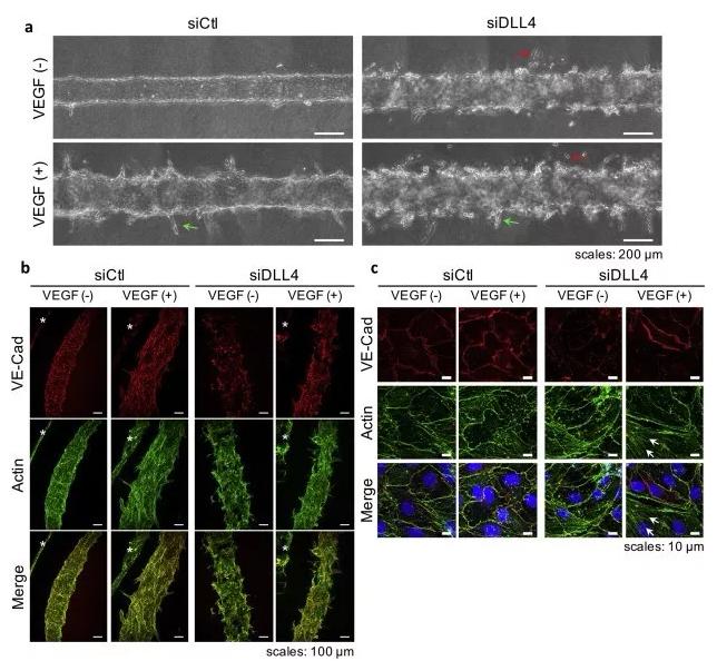 敲除DLL4將影響血管的新生和穩(wěn)定性。圖片來源：EBioMedicine