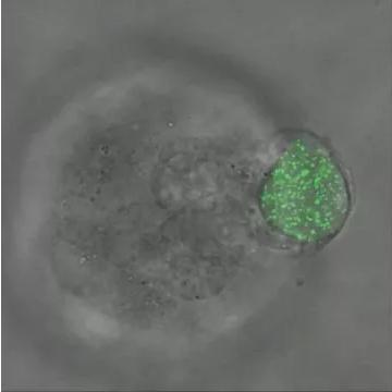 華中科大研發(fā)出測量三維生物力的新技術，有望用于癌癥早期診斷